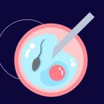 Assisted Reproduction
